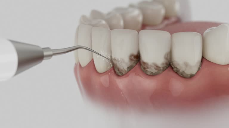 Trusted Invisalign Clear Aligners service in Oakley, KS - Dentist Open Now